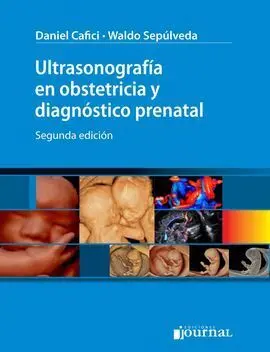 Ultrasonografía en Obstetricia y Diagnóstico Prenatal