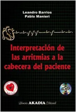 Interpretacion de las Arritmias a la Cabecera del Paciente