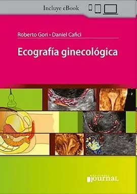 Ecografía Ginecológica