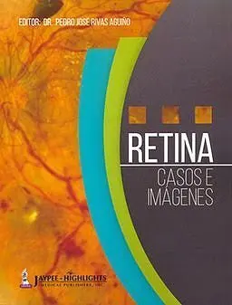 Retina. Casos e Imágenes