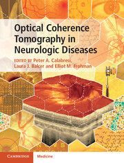 OPTICAL COHERENCE TOMOGRAPHY IN NEUROLOGIC DISEASES (JULIO-15)