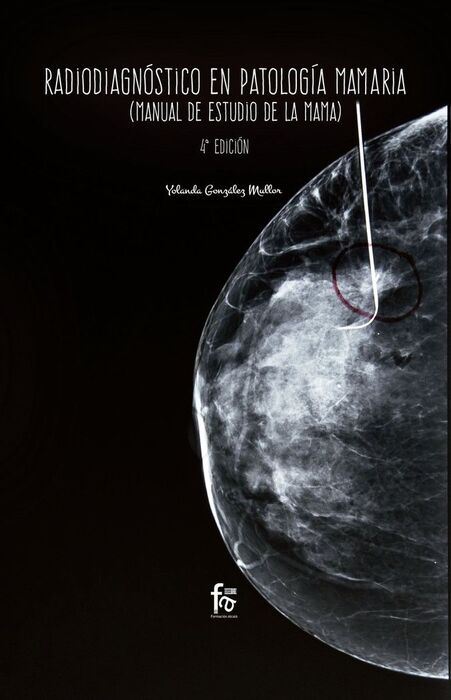 RADIODIAGNOSTICO EN PATOLOGIA MAMARIA 4ªED