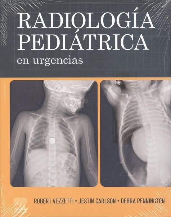 RADIOLOGÍA PEDIÁTRICA EN URGENCIAS
