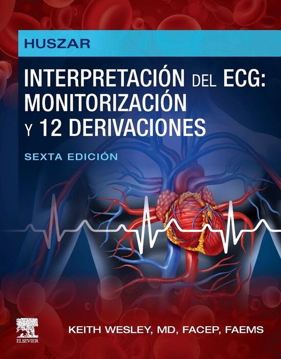 HUSZAR:INTERPRETACION  ECG:MONITORIZACION 12 DERIVACIONES