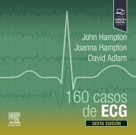 160 CASOS DE ECG