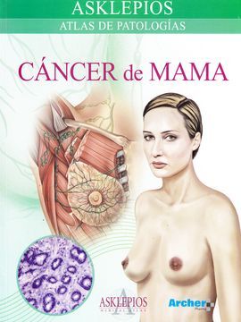 ATLAS DE CÁNCER DE MAMA