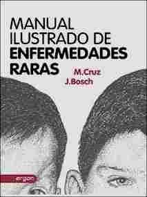 MANUAL ILUSTRADO DE ENFERMEDADES RARAS