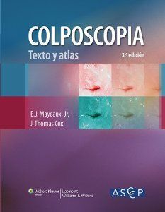 COLPOSCOPIA