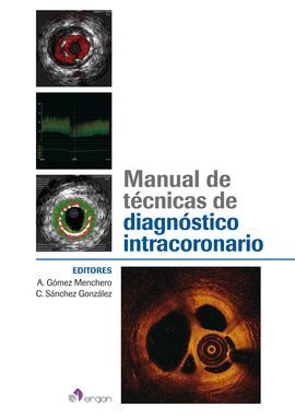 MANUAL DE TÉCNICAS DE DIAGNÓSTICO INTRACORONARIO
