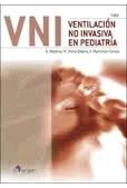 VENTILACIÓN NO INVASIVA EN PEDIATRÍA