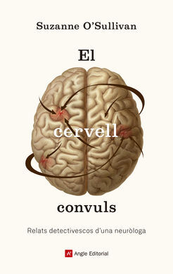 CERVELL CONVULS,EL