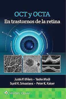 OCT Y OCTA EN TRASTORNOS DE LA RETINA