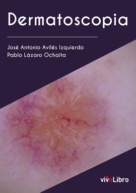 DERMATOSCOPIA