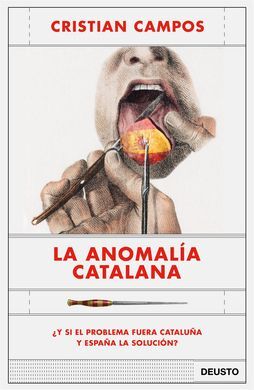 LA ANOMALIA CATALANA