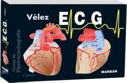 ECG