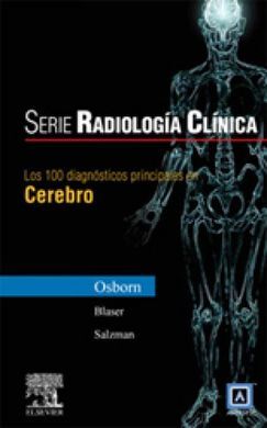 LOS 100 DIAGNOSTICOS PRINIPALES EN EL CEREBRO