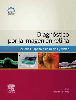 DIAGNÓSTICO POR LA IMAGEN EN RETINA