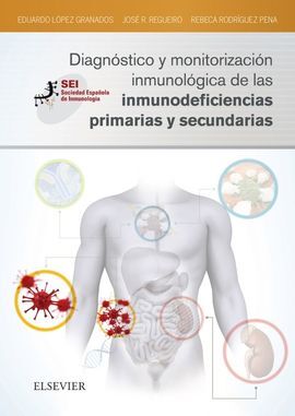 DIAGNÓSTICO Y MONITORIZACIÓN INMUNOLÓGICA DE LAS INMUNODEFICIENCIAS PRIMARIAS Y
