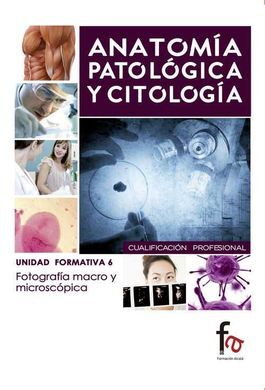 ANATOMÍA PATOLÓGICA, UNIDAD 6: FOTOGRAFÍA MACRO