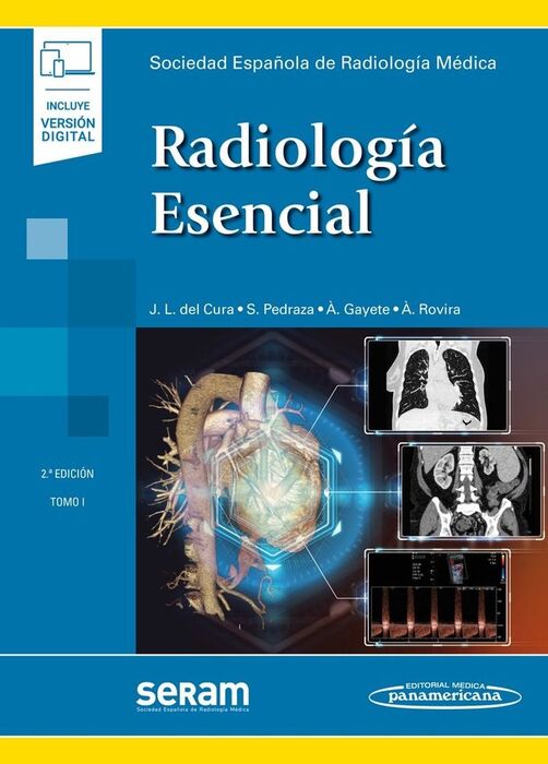 RADIOLOGIA ESENCIAL  2ED, 2TOMOS