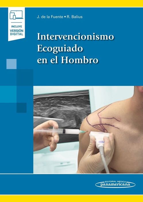 INTERVENCIONISMO ECOGUIADO EN EL HOMBRO INCLUYE EBOOK