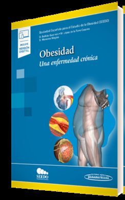 OBESIDAD (+ E-BOOK)