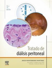 TRATADO DE DIÁLISIS PERITONEAL