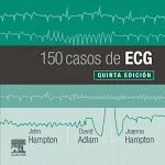 150 CASOS DE ECG