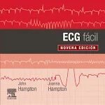 ECG FACIL