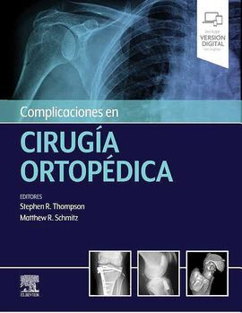 COMPLICACIONES EN CIRUGÍA ORTOPÉDICA