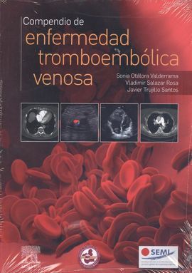 COMPENDIO DE ENFERMEDAD TROBOEMBOLICA VENOSA