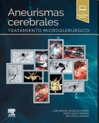 ANEURISMAS CEREBRALES