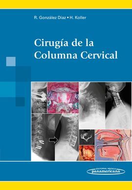 CIRUGÍA DE LA COLUMNA CERVICAL