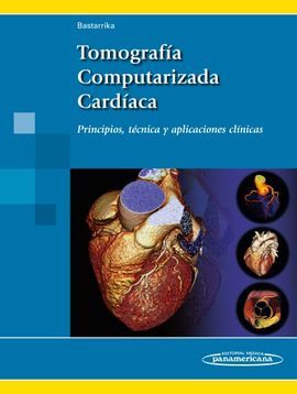 TOMOGRAFÍA COMPUTARIZADA CARDÍACA