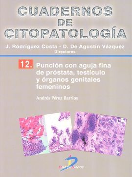 PUNCION CON AGUJA FINA DE PROSTATA...