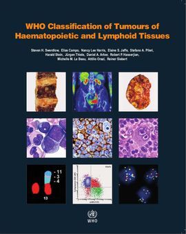 WHO CLASSIFICATION OF TUMOURS OF HAEMATOPOIETIC AND LYMPHOID TISSUES. 4ª ED.