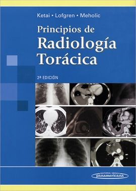 PRINCIPIOS DE RADIOLOGÍA TORÁCICA