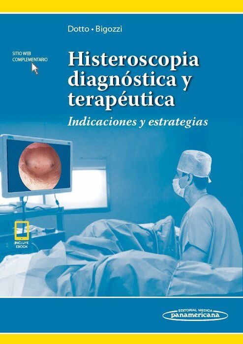 HISTEROSCOPIA DIAGNÓSTICA Y TERAPÉUTICA.