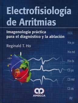 ELECTROFISIOLOGIA DE ARRITMIAS