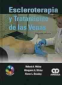 ESCLEROTERAPIA Y TRATAMIENTO DE LAS VENAS