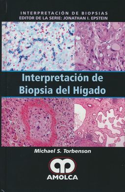 INTERPRETACIÓN DE BIOPSIA DEL HIGADO