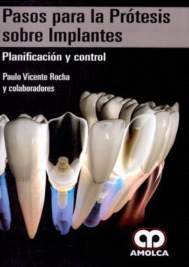 PASOS PARA LA PROTESIS SOBRE IMPLANTES. PLANIFICACION Y CONTROL
