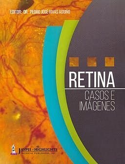 RETINA. CASOS E IMÁGENES